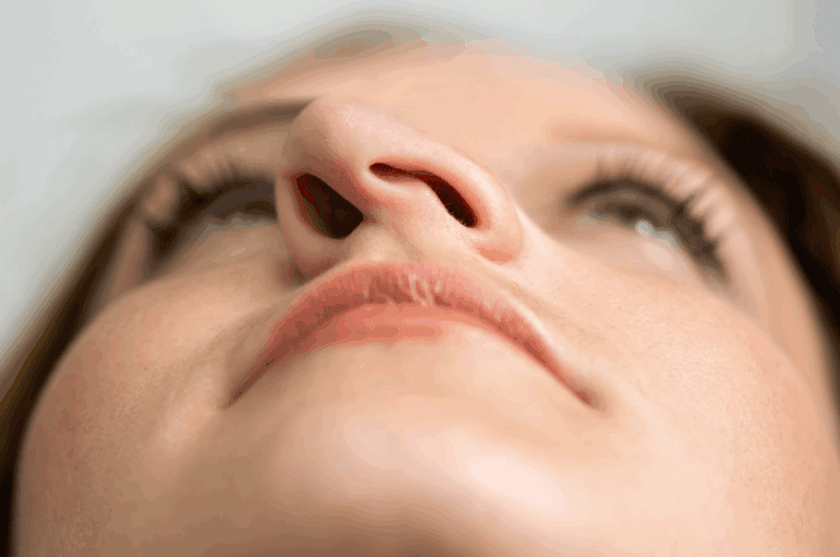 what is septoplasty